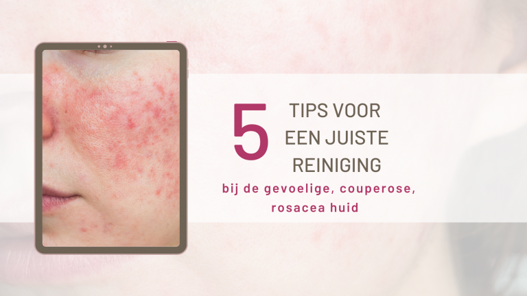 5 tips om een gevoelige, couperose, rosacea huid op een juiste manier te reinigen.